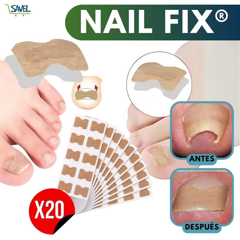 NailFix® Olvídate de sufrir de uñas encarnadas